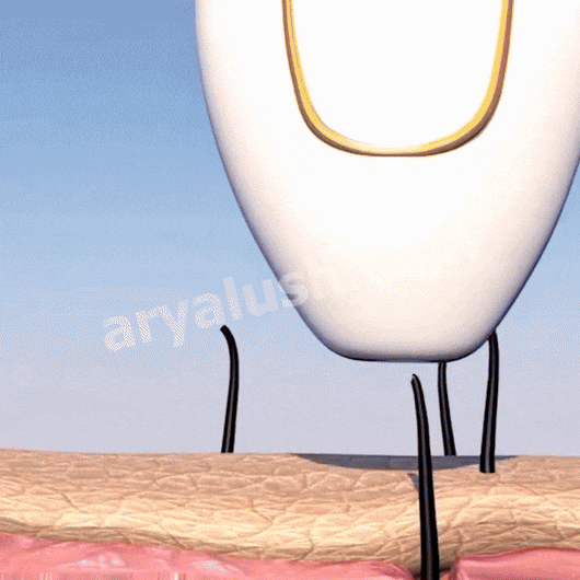 IPL Pulse • Épilateur à Lumière Pulsée