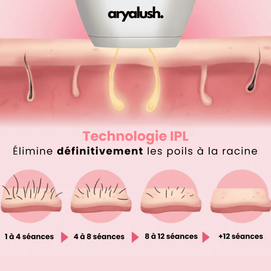 IPL Pulse • Épilateur à Lumière Pulsée