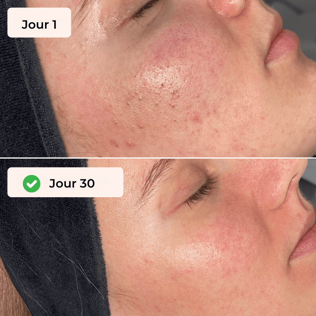 Gant Exfoliant Corps & Visage
