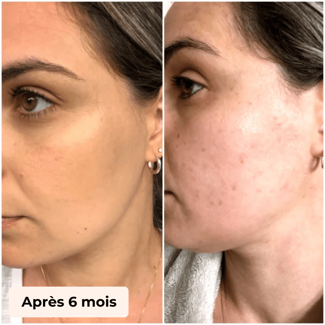 Gant Exfoliant Corps & Visage