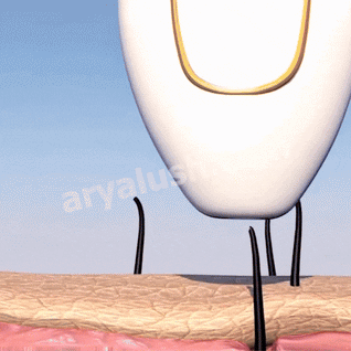 IPL Pulse • Épilateur à Lumière Pulsée