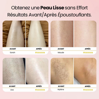 Aura Pro • Rasoir Électrique 5 en 1