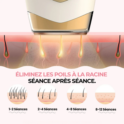 IPL Pro • Épilateur à Lumière Pulsée