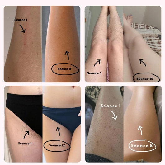 Pack Épilation : Exfoliant, Épilation & Hydratation