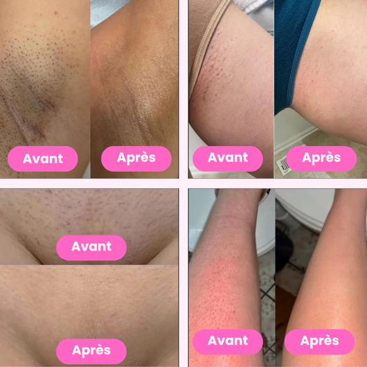 Aura Pro • Rasoir Électrique 5 en 1