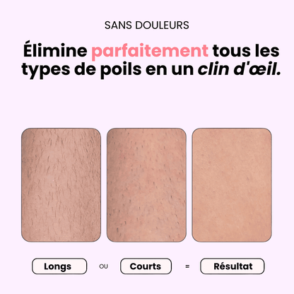 Lady Shaver • Épilateur Électrique